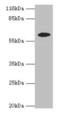 Epoxide Hydrolase 2 antibody, CSB-PA007735LA01HU, Cusabio, Western Blot image 