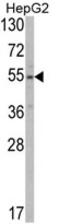 Solute Carrier Family 38 Member 3 antibody, AP17749PU-N, Origene, Western Blot image 