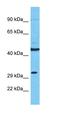 Solute carrier family 25 member 38 antibody, orb327276, Biorbyt, Western Blot image 