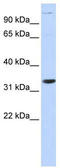Acidic Nuclear Phosphoprotein 32 Family Member B antibody, TA340107, Origene, Western Blot image 