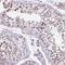 ZFP3 Zinc Finger Protein antibody, HPA053085, Atlas Antibodies, Immunohistochemistry frozen image 