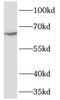 1-Aminocyclopropane-1-Carboxylate Synthase Homolog (Inactive) antibody, FNab06368, FineTest, Western Blot image 
