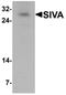 SIVA1 Apoptosis Inducing Factor antibody, orb75703, Biorbyt, Western Blot image 