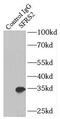 Sfrs2 antibody, FNab07790, FineTest, Immunoprecipitation image 
