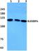 RAN Binding Protein 6 antibody, A15427-2, Boster Biological Technology, Western Blot image 
