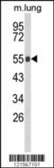 Glucosylceramidase Beta antibody, MBS9202426, MyBioSource, Western Blot image 