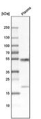 Immunoglobulin Superfamily Containing Leucine Rich Repeat antibody, NBP2-14131, Novus Biologicals, Western Blot image 
