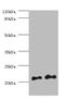 HRas Proto-Oncogene, GTPase antibody, A54527-100, Epigentek, Western Blot image 