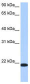 Transmembrane P24 Trafficking Protein 4 antibody, TA344031, Origene, Western Blot image 