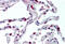 C-C Motif Chemokine Receptor 1 antibody, MBS241826, MyBioSource, Immunohistochemistry frozen image 