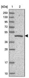 Chromosome 19 Open Reading Frame 47 antibody, PA5-59751, Invitrogen Antibodies, Western Blot image 