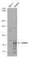 Glycoprotein Nmb antibody, GTX103277, GeneTex, Western Blot image 