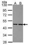 Zinc Finger Protein 396 antibody, GTX106227, GeneTex, Western Blot image 