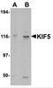 KIF5A antibody, 4289, ProSci Inc, Western Blot image 