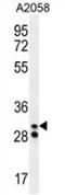 HLE antibody, AP52858PU-N, Origene, Western Blot image 