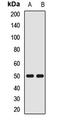 Sulfide Quinone Oxidoreductase antibody, LS-C668303, Lifespan Biosciences, Western Blot image 