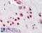 NOVA Alternative Splicing Regulator 1 antibody, LS-B3259, Lifespan Biosciences, Immunohistochemistry paraffin image 