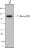 Phosphoinositide-3-Kinase Regulatory Subunit 2 antibody, MAB6777, R&D Systems, Western Blot image 