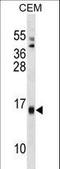 Serum Amyloid A4, Constitutive antibody, LS-C162847, Lifespan Biosciences, Western Blot image 