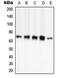 Serine/threonine-protein kinase PAK 3 antibody, LS-C352628, Lifespan Biosciences, Western Blot image 