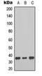 Melatonin Receptor 1B antibody, LS-C368434, Lifespan Biosciences, Western Blot image 