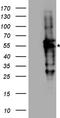 DNA repair protein RAD52 homolog antibody, TA890144, Origene, Western Blot image 