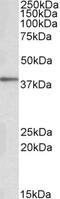 Nuclear receptor-interacting protein 1 antibody, 43-129, ProSci, Western Blot image 