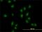 AT-Rich Interaction Domain 1B antibody, H00057492-M02, Novus Biologicals, Immunocytochemistry image 