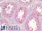 Clusterin antibody, LS-B2852, Lifespan Biosciences, Immunohistochemistry paraffin image 