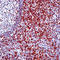 CD5 Molecule antibody, LS-C88152, Lifespan Biosciences, Immunohistochemistry paraffin image 