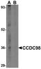 Abraxas 1, BRCA1 A Complex Subunit antibody, NBP1-76827, Novus Biologicals, Western Blot image 