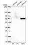 DEAD-Box Helicase 5 antibody, NBP1-83406, Novus Biologicals, Western Blot image 