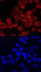 Bruton Tyrosine Kinase antibody, MAB5807, R&D Systems, Immunofluorescence image 