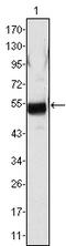 Fibrinogen Beta Chain antibody, M01204, Boster Biological Technology, Western Blot image 