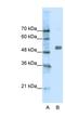 Cholinergic Receptor Nicotinic Alpha 9 Subunit antibody, NBP1-79949, Novus Biologicals, Western Blot image 