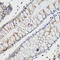 Charged Multivesicular Body Protein 4B antibody, 22-916, ProSci, Immunohistochemistry frozen image 