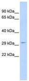 Shisa Family Member 5 antibody, TA342014, Origene, Western Blot image 