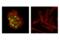 Progesterone Receptor antibody, 35591S, Cell Signaling Technology, Immunofluorescence image 