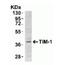 KIM-1 antibody, NBP1-76701, Novus Biologicals, Western Blot image 
