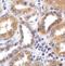 Thioredoxin Interacting Protein antibody, A01409, Boster Biological Technology, Immunohistochemistry paraffin image 