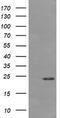 Deleted In Primary Ciliary Dyskinesia Homolog (Mouse) antibody, M12820, Boster Biological Technology, Western Blot image 