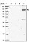 RAB11 Binding And LisH Domain, Coiled-Coil And HEAT Repeat Containing antibody, PA5-58893, Invitrogen Antibodies, Western Blot image 