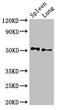 AD4 antibody, LS-C679216, Lifespan Biosciences, Western Blot image 