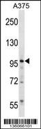 Zinc Finger Protein 541 antibody, 58-662, ProSci, Western Blot image 