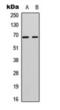 A-Raf Proto-Oncogene, Serine/Threonine Kinase antibody, orb393209, Biorbyt, Western Blot image 