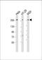 Pecanex 2 antibody, 61-176, ProSci, Western Blot image 