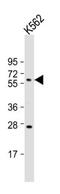 Histidine Rich Glycoprotein antibody, MBS9206826, MyBioSource, Western Blot image 