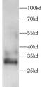 Galactosylceramidase antibody, FNab10708, FineTest, Western Blot image 