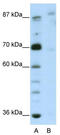 Zinc finger protein GLIS3 antibody, TA345560, Origene, Western Blot image 