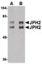 Junctophilin 2 antibody, PA5-20642, Invitrogen Antibodies, Western Blot image 